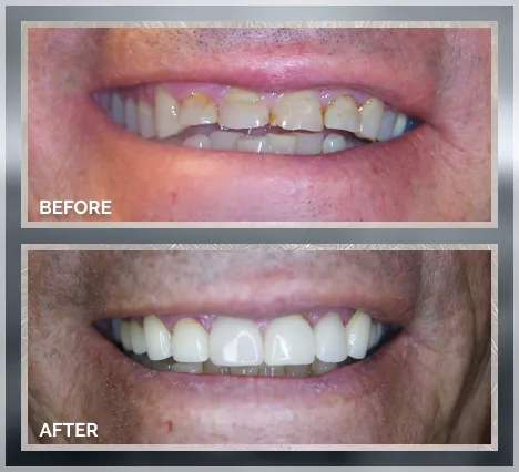 Smile transformation result 4