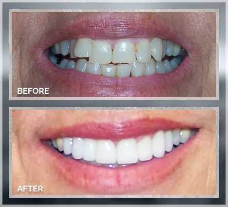 Smile transformation result 5